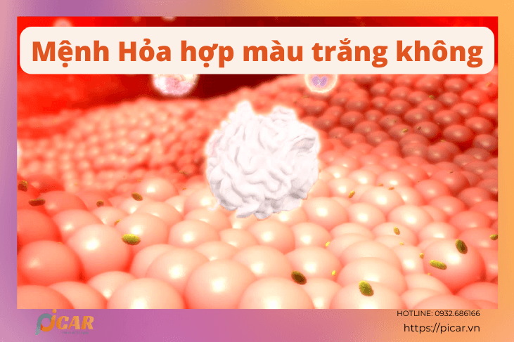 Mệnh Hỏa hợp màu trắng không Mệnh Hỏa hợp màu trắng không